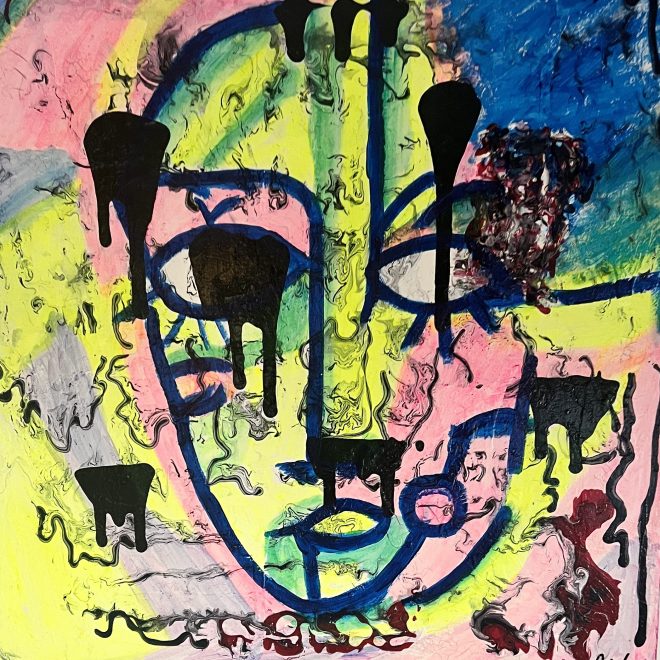 3-Anthony Wolf--Open head